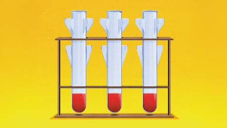 Klog oprustning kan styrke innovation og vækst i samfundet