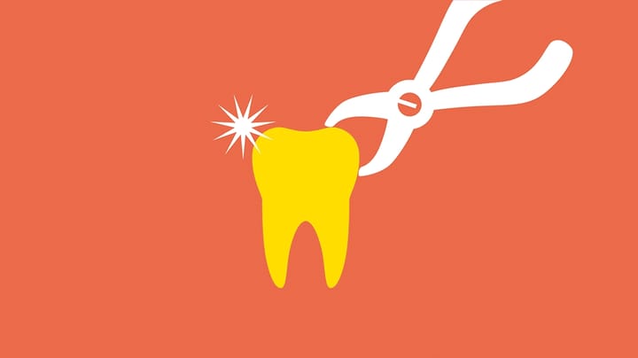 Smuthulskontrakter truer kæmpeinvesteringer i tandlægekæder